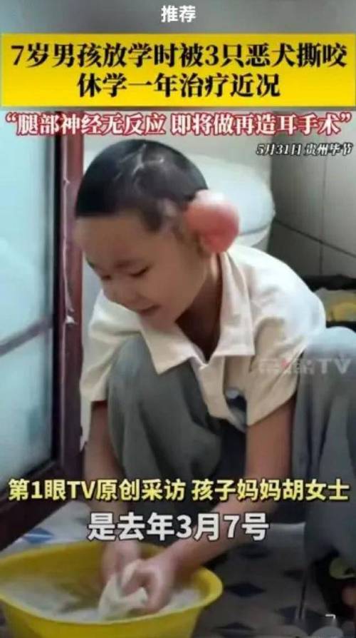 澳门49图库和7岁男孩遭3只犬撕咬与7岁男孩遭3只犬撕咬怎么办